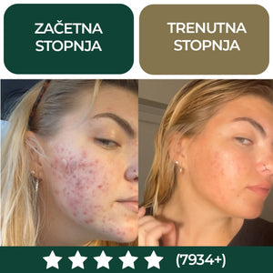 Golden anti-acne set